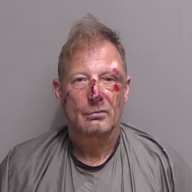 A middle aged man with short, disheveled hair and visible injuries, including blood and bruises on his face, wearing a gray garment, stands against a plain light gray background