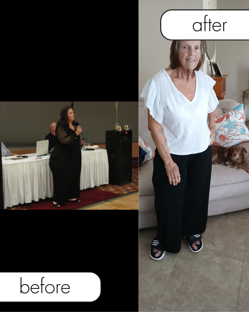 Side by side “before” and “after” images show a woman with noticeable weight loss, standing in both photos In the “after” image, she wears black pants and a white top, with the scenic backdrop of Flagler Beach adding an extra touch of inspiration to her transformation