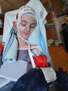 A young person in a hospital bed with a helmet and medical tape on their head, wearing a hospital gown and covered by blankets, with medical equipment and receipts visible nearby