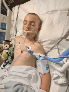 A young boy lies in a hospital bed with a breathing tube, electrodes, and a blood pressure cuff He is surrounded by stuffed toys and medical equipment His eyes are closed
