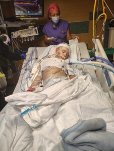 A child lies in a hospital bed connected to medical equipment and monitors, with a nurse standing nearby wearing a mask and gloves The room is filled with wires and medical devices